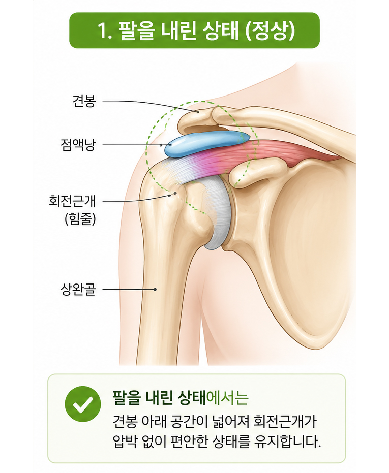 대구 어깨통증 정상 어깨