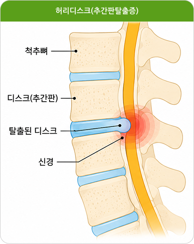 이미지2 설명글