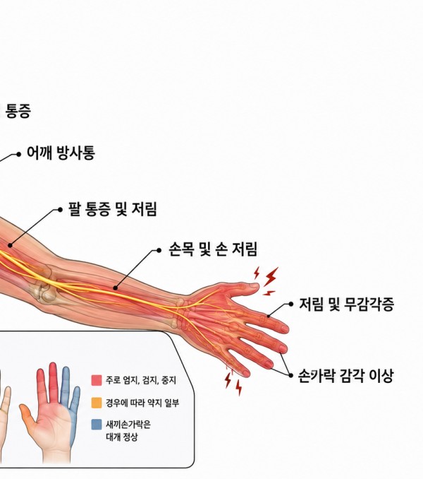 팔이 저린데 목디스크래요